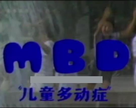 MBD儿童多动症